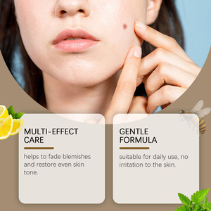 HOYGI <strong>Skin</strong> <strong>Tags</strong> <strong>Remove</strong> Revitalizer Facial <strong>Cream</strong> Gentle Moles Cleansing Smoothing <strong>Skin</strong> Blemish Cover Face Care for <strong>Skin</strong> Spots 60g - Product Image 4