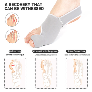 Cómodo Corrector de juanetes Férula de <span class=keywords><strong>dedo</strong></span> grande <span class=keywords><strong>Martillo</strong></span> Enderezador de dedos Hallux Valgus Separador de dedos - Product Image 4