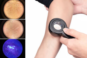 <span class=keywords><strong>Dermatoscope</strong></span> électronique IBOOLO DE-3100 PRO <span class=keywords><strong>Dermatoscope</strong></span> à lumière LED polarisée et UV pour la dermatologie - Product Image 2