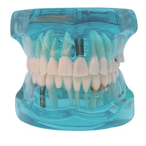 Modèle dentaire anatomique Heidefee, 28 dents, silicone médical, rapport 1 à 1, pour l'enseignement des sciences médicales - Product Image 1