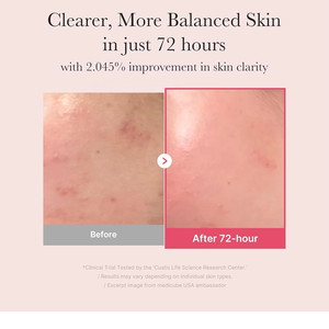Produits cosmétiques coréens Medicube Soins de la peau Sérum pour le visage Sérum Medicube TXA+Niacinamide 15 Sérum 30ml - Product Image 4
