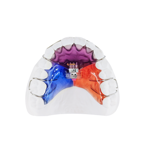 <span class=keywords><strong>Appareil</strong></span> orthodontique amovible Hawley en acrylique pour la rétention post-traitement et la personnalisation - Product Image 4