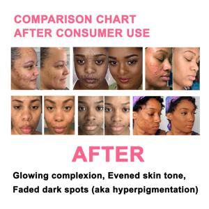 <span class=keywords><strong>DR</strong></span>.DAVEY Face Serum Iluminador Limpieza Puntos negros Crema facial para todo tipo de piel - Product Image 4