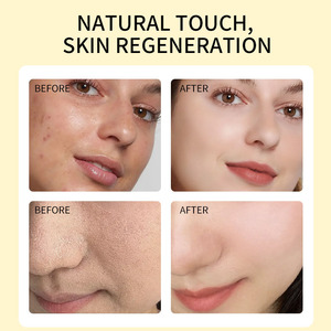 <span class=keywords><strong>Huile</strong></span> de graines de figue de Barbarie 100% pure et biologique, <span class=keywords><strong>huile</strong></span> essentielle pure, <span class=keywords><strong>extra</strong></span> <span class=keywords><strong>vierge</strong></span>, pressée à froid, pour le visage, les cheveux et le corps, marque privée OEM - Product Image 6