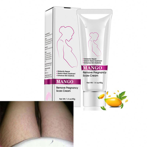 Körper hautpflege Hautre paratur Schwangerschaft narben entfernen Dehnung streifen entfernen Creme - Product Image 4
