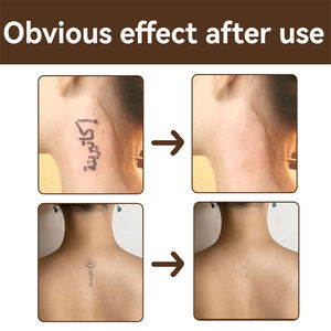 EELHOE Tattoo Concealer Scar Berthmark Vitiligo Ecchymoses Taches pigmentées Chloasma Hickey Covering Cream - Product Image 5