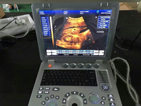 Mesin Ultrasound Gema 3D 4D Portabel Ultrasound Manusia Hemat Biaya