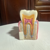 Modelo DE EDUCACIÓN anatómica para caries dental 6 demostraciones de sección transversal bilateral para estudio de ciencia médica