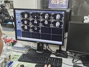 Scanner IRM mobile réutilisable EUR VET pour animaux de compagnie, usage chirurgical orthopédique, diagnostic, équipement médical - Product Image 6