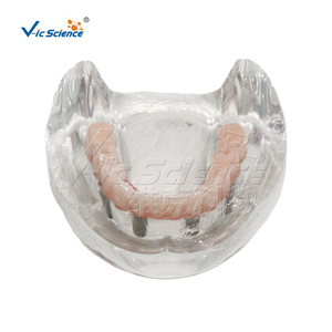 Modelo de restauración de implantes mandibulares de alta precisión M6001-1; Demostración de restauración Ma Longqiao; Entrenamiento para la escuela de medicina. - Product Image 1