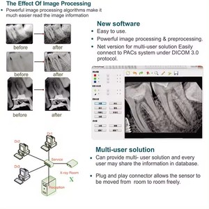 Sensor de Rayos X Dental Veterinario Digital, Sistema de Imágenes sin Película RVG, Sensor de Rayos X para Dientes de Mascotas, Alta Resolución, RVG para Clínica Veterinaria - Product Image 6