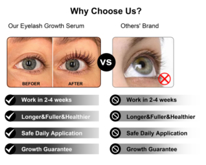 Sérums de croissance des <span class=keywords><strong>cils</strong></span> liquides personnalisables avec logo – Traitement bio <span class=keywords><strong>et</strong></span> naturel pour la croissance des <span class=keywords><strong>cils</strong></span> <span class=keywords><strong>et</strong></span> des <span class=keywords><strong>sourcils</strong></span> – Activateur de croissance des <span class=keywords><strong>cils</strong></span> – Marque privée - Product Image 5