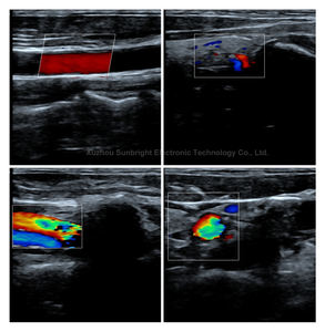 Dokter Hewan pencitraan otot ultrasound 3 in 1 probe nirkabel WIFI warna <span class=keywords><strong>doppler</strong></span> ultrasound - Product Image 5
