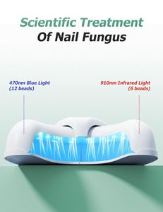<span class=keywords><strong>Appareil</strong></span> portable de traitement des mycoses des ongles 36W avec lumière infrarouge 905nm et lumière bleue 470nm <span class=keywords><strong>pour</strong></span> usage domestique - Product Image 2