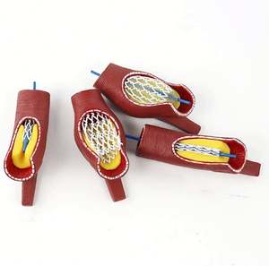 Modelo de <span class=keywords><strong>stent</strong></span> vascular humano KyrenMed, soporte de bloqueo de vasos sanguíneos cardiovasculares de arteria coronaria, modelo de bloqueo de vasos sanguíneos - Product Image 5