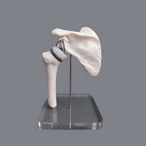 Modelo de Reemplazo de Articulación del Hombro de Tamaño Mini, Prótesis Simulada de Escápula y Húmero, Espécimen Óseo para Anatomía de Implantes de Articulación del Hombro - Product Image 2