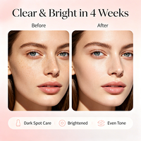 Sérum éclaircissant à la niacinamide pour éliminer les taches brunes, sérum visage quotidien léger à base d'eau, marque privée