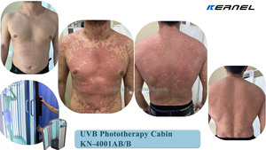 Cabina <span class=keywords><strong>de</strong></span> Fototerapia NB-UVB <span class=keywords><strong>de</strong></span> Cuerpo Completo para el Tratamiento del Vitiligo y la Psoriasis en Clínicas Dermatológicas, <span class=keywords><strong>Control</strong></span> <span class=keywords><strong>de</strong></span> Dosis UV, 26 Piezas UVA UVB - Product Image 6
