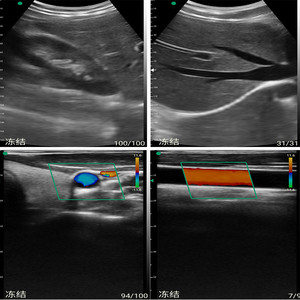 High Quality Handheld Linear <strong>USG</strong> Medical <strong>Machine</strong> Wireless Portable Ultrasound Scanner Medical IOS Android Linear Ultrasound - Product Image 3