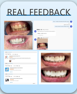 Tiras Blanqueadoras de Dientes con Corrección de Color V34 Premium, Suministro de Alta Gama para el Cuidado Dental - Product Image 4
