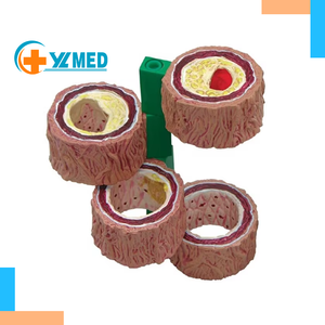 Высококачественная медицинская модель анатомии для развития органов и сосудов со склеротическими функциями для обучения медсестер - Product Image 1