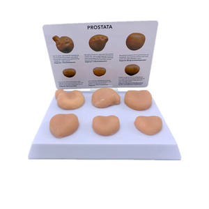 Modelo Anatómico de Tumor Prostático Humano para Ciencias Médicas, Modelo de Anatomía Humana - Product Image 1