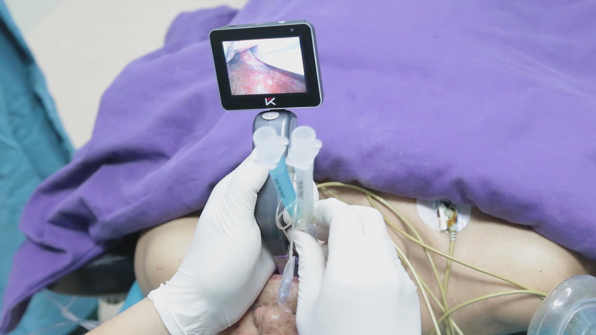 3" TFT OLED Surgical Handheld Video Laryngoscope 18650 Rechargeable