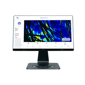 Nouvel arrivage : Analyseur de santé du cuir chevelu AI avec Wi-Fi pour usage commercial - Product Image 4