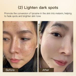 Sérum Visage Bio Pur à l'Acide Hyaluronique et Vitamine C en Gros – Soin de la Peau à la Vitamine C - Product Image 6