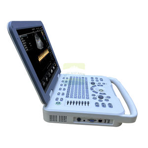 Promotion : Sonographe Doppler Portable pour Animaux – Échographe <span class=keywords><strong>USG</strong></span> pour Bétail et Animaux de Compagnie avec Sonde d'Examen - Product Image 1