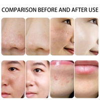 Machine de beauté faciale à l'eau hydrogène-oxygène 360° très vendue avec écran 10,1 pouces, machine hydro-faciale 6 en 1