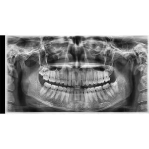 Promax 3D Mid <span class=keywords><strong>Dental</strong></span> CBCT Dijital Panoramik Röntgen Cihazı <span class=keywords><strong>OPG</strong></span> 3D Cihazı - Product Image 5
