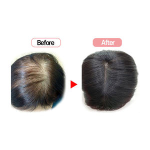 Perruque pour femmes Cosmo en Corée Premium (20x19)-12 pouces, perruque en cheveux humains de haute qualité, lisse, droite, style naturel pour femmes - Product Image 5