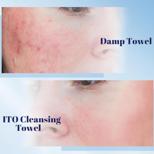 <span class=keywords><strong>WIPEX</strong></span> Oem 100% Organic Soft Lavage des mains et du visage Papier hygiénique Salon Spa Maquillage Serviette jetable propre pour le visage - Product Image 5