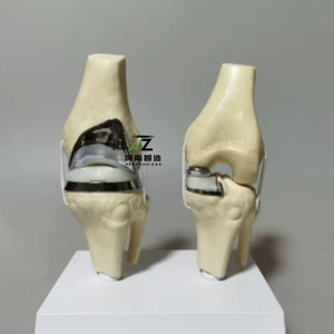 Nuevo modelo de prótesis de rodilla artificial desmontable 2025, conjunto de modelo de implante de articulación de rodilla doble pequeña plateada - Product Image 3