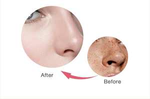 Crème pour le visage QBEKA pour éliminer les taches de rousseur, crème éclaircissante pour le visage avec des ingrédients naturels, <span class=keywords><strong>correcteur</strong></span> de taches brunes pour tous les types de peau - Product Image 6