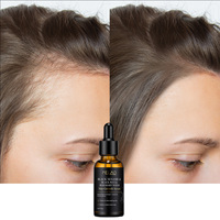 Suero para el Crecimiento del Cabello de Marca Propia de 30 ml con Romero, Biotina y Cafeína, Suero Natural para el Cuidado del Cuero Cabelludo a Base de Granos, Unisex