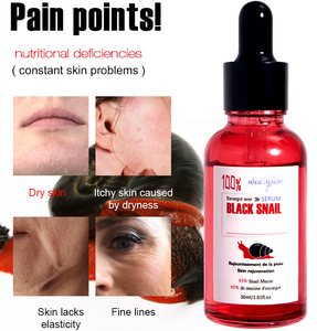 Esencia Black Snail Plus con filtrado de secreción de caracol negro, suero hidratante y reparador, hidrata, aclara las <span class=keywords><strong>manchas</strong></span> oscuras, OEM/ODM - Product Image 5
