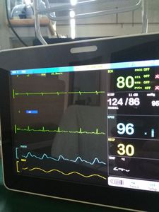 Rsd6000v पालतू क्लिनिक अस्पताल पशु चिकित्सा महत्वपूर्ण संकेत मल्टीपैराट्रो पशु चिकित्सा निगरानी etco2 - Product Image 2