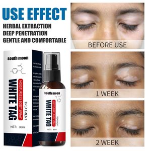 Spray per la vitiligine della luna meridionale idratante macchie bianche malattia della leucoplachia pigmento melanina White Tag Care - Product Image 3