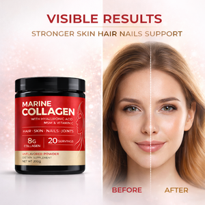 Collagène marin hydrolysé de qualité supérieure OEM en poudre avec vitamines <span class=keywords><strong>pour</strong></span> la beauté des <span class=keywords><strong>cheveux</strong></span>, de la peau, des <span class=keywords><strong>ongles</strong></span> <span class=keywords><strong>et</strong></span> des articulations – Complément alimentaire en vrac - Product Image 4