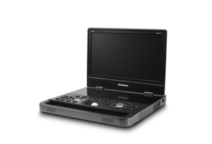 SonoScape E11, Nuevo Diseño, Ecógrafo Doppler Color Digital Portátil Profesional para Animales y Nuevo Producto de Ecografía Veterinaria - Product Image 4