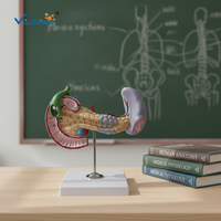 Modelo de anatomía del cuerpo humano, enfermedades del páncreas y la médula, modelo de enseñanza médica patológica