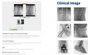 MSLCX15 مستشفى المهنية الكل في واحد آلة التنظير الرقمية الذراع سي آلة الأشعة السينية الكهربائية - Product Image 6