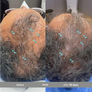 Siero per la Densità dei Capelli ETRUN ALISA 60mL, Trattamento Leggero Senza Risciacquo per Capelli dall'Aspetto Più Folti e Spessi, Anti-Grigio Preserva il Pigmento - Product Image 5