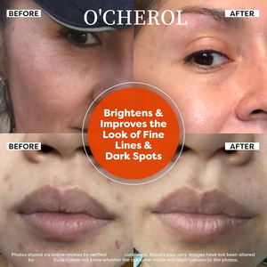 Siero Viso ODM con Vitamina C e Niacinamide Schiarente Illuminante Lenitivo con Acido Ialuronico 30ml per Uso Domestico Femminile - Product Image 4