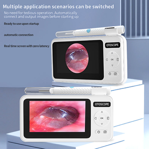 เครื่องมือกำจัดขี้หู T29 Visual Wi-Fi พร้อมหน้าจอ IPS ขนาด 4.3 นิ้ว กล้องดิจิตอลตรวจหูในตัว เลนส์กล้องความละเอียดสูง 1080P ขนาด 3.9 มม. สำหรับการดูแลคนและสัตว์เลี้ยง - Product Image 6