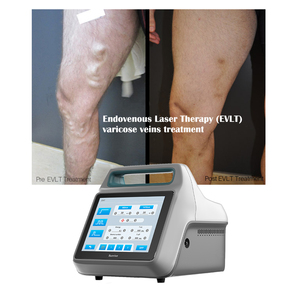 Láser de diodo de 980nm y 1470nm para coagulación venosa EVLT/EVLA, ablación médica intravenosa para venas varicosas en las <span class=keywords><strong>piernas</strong></span> - Product Image 1