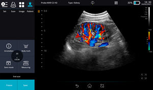 Scanner portable à main, sonde linéaire convexe sans fil interchangeable, appareil d'échographie vétérinaire pour animaux de compagnie et humains - Product Image 6