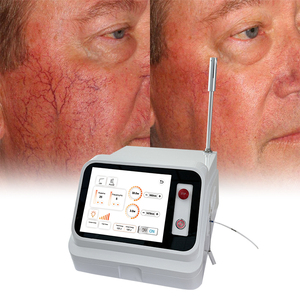 Sunrise 980nm Tratamiento de Onicomicosis, Fisioterapia, Eliminación Vascular, Arañas Vasculares, Capilares, Várices y Telangiectasias - Product Image 3